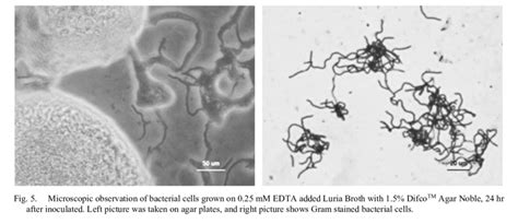 Colony formation on 0.25 mM EDTA added Luria Broth plates with 1.5% ...