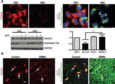 Acetylated Tubulin And HDAC6 Staining In MN1 Cells And Human Spinal