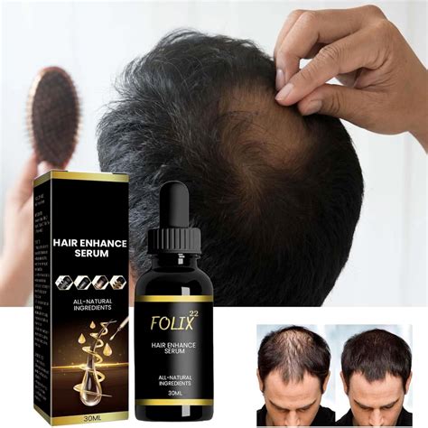 Folix22 Hair Growth Formula Folix22 Hair Growth Serum Natur Hair Oils