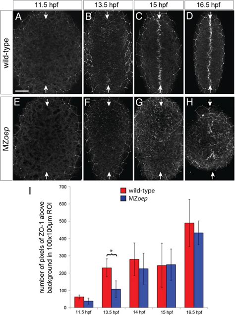 Apical Polarity Development In Mzoep Zo 1 Staining In Abcd Download Scientific Diagram