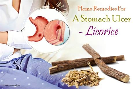 16 Safe Home Remedies For A Stomach Ulcer Pain Relief