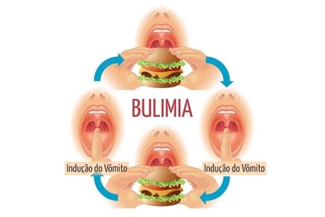 Anorexia ou Bulimia quais as principais diferenças Tua Saúde