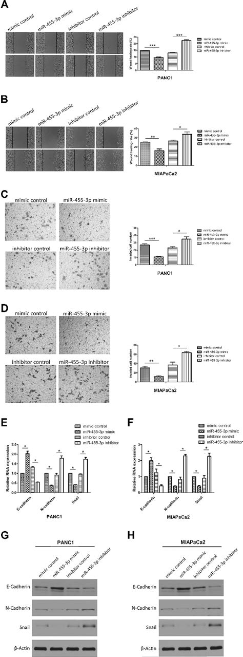 Mir 455 3p Inhibits Emt Mediated Metastasis In Pancreatic Cancer Cells