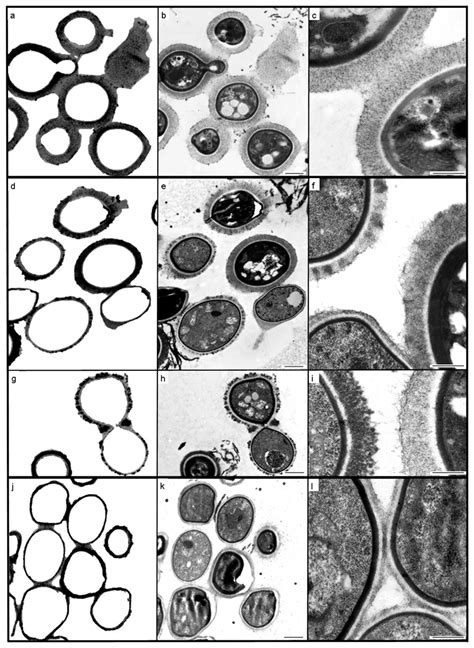 TropicalMed Free Full Text Cryptococcus Neoformans Diagnostic