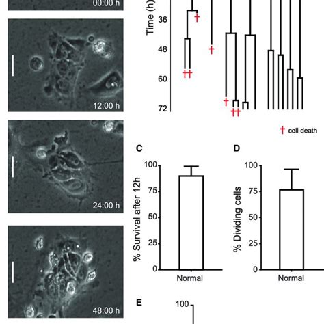 Time Lapse Analysis Of Normal H7 S14 Cells Passaged In Small Clumps