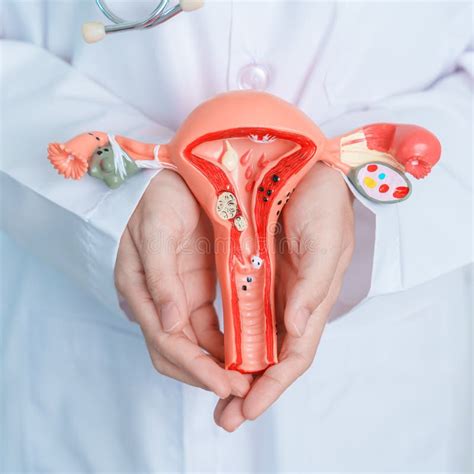 Doctor Holding Uterus And Ovaries Model Ovarian And Cervical Cancer Cervix Disorder