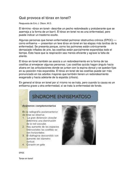 Qué Provoca El Tórax En Tonel Estudi Anatomía Studocu