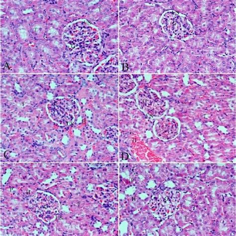 Photomicrograph X400 Of The Liver Sections Stained With Hemotoxaline Download Scientific