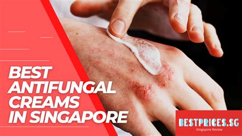 Best Antifungal Creams In Singapore 2023 To Kill Fungal Infections