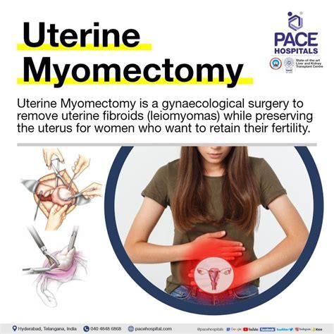 Myomectomy Surgery in Hyderabad - Indications, Side effects & Benefits