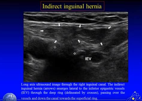 If We Move A Little Bit Medial To Position 3 We Are Looking At The