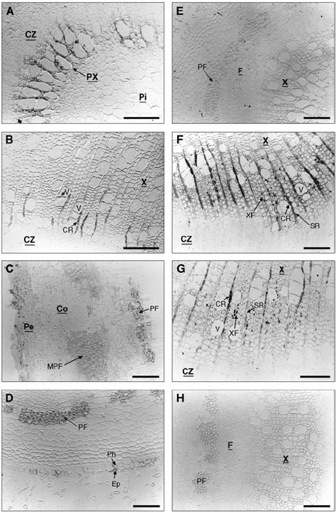 Immunolocalization Of Ccoaomt In Transversal Sections Of Poplar Stem By