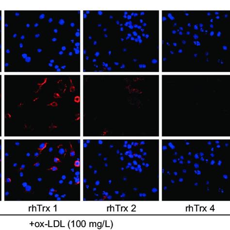 Rhtrx Protects Raw2647 Cells From Ox Ldl Induced Foam Cell Formation