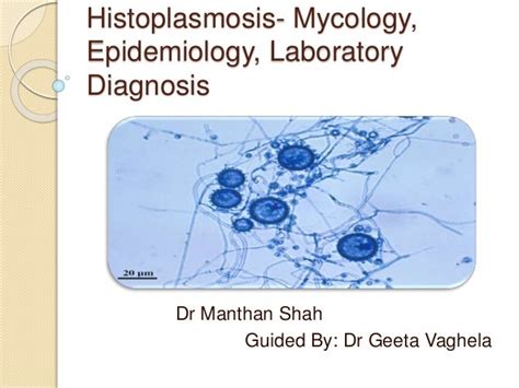 Histoplasmois Mycology Epidemiology Laboratory Diagnosis