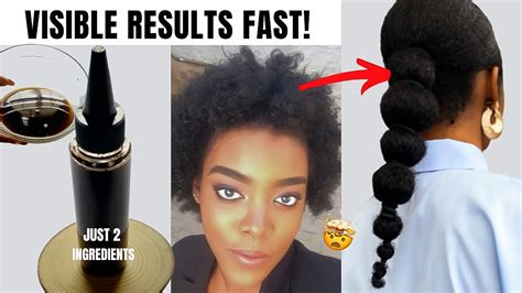 VISIBLE RESULTS FAST Mix Clove Coffee To Grow Hair Treat Baldness