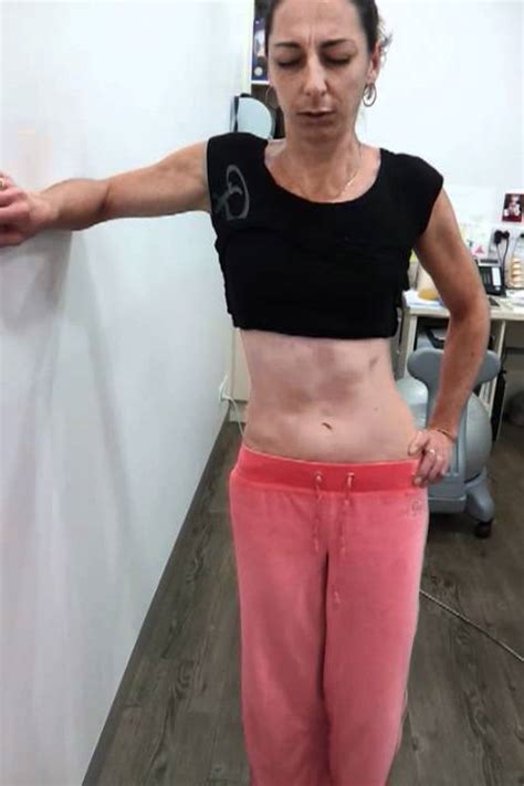 lateral shift day  initial  youtube