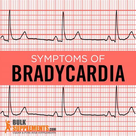 Bradycardia: Symptoms, Causes & Treatment