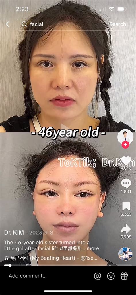 This Plastic Surgeon I Found On Tiktok R Oddlyterrifying