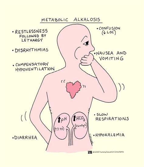 metabolic alkalosis #nursing #nclex #testbankworld | Nursing school ...