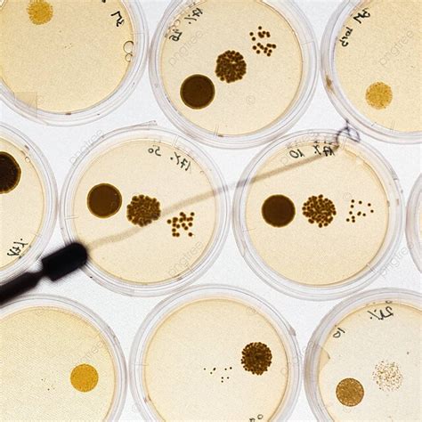 Fondo Cultivo De Bacterias En Placas De Petri An Lisis Experimento Con