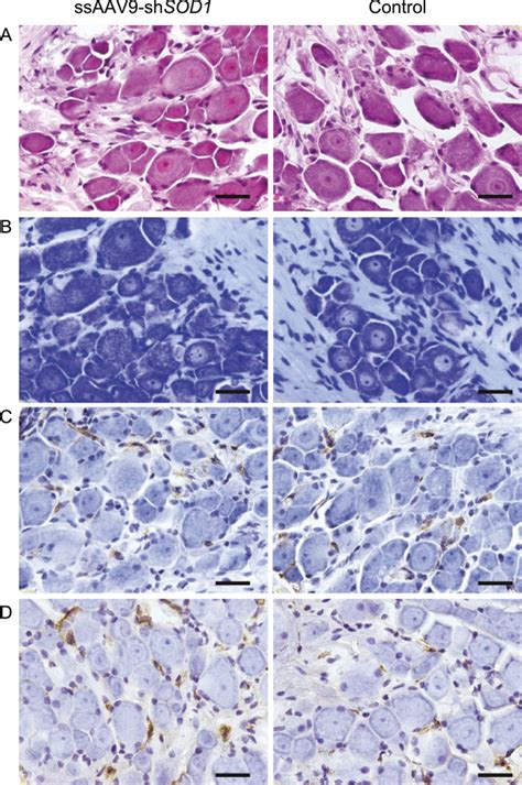 Pathological Examination Of Drg Photomicrographs Of Hematoxylin And