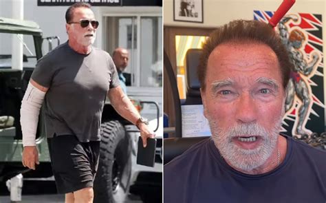 Arnold Schwarzenegger Shows Off Bandaged Arm After Undergoing Elbow ...