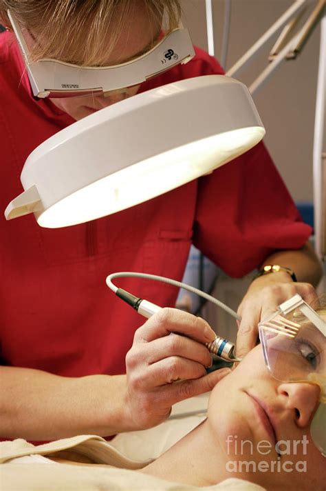 Laser Thread Vein Treatment Photograph By Michael Donne Science Photo