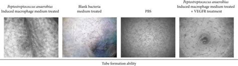 The effect of Peptostreptococcus anaerobius upon tube formation for ...