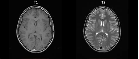 The Basics Of MRI Interpretation Radiology Geeky Medics