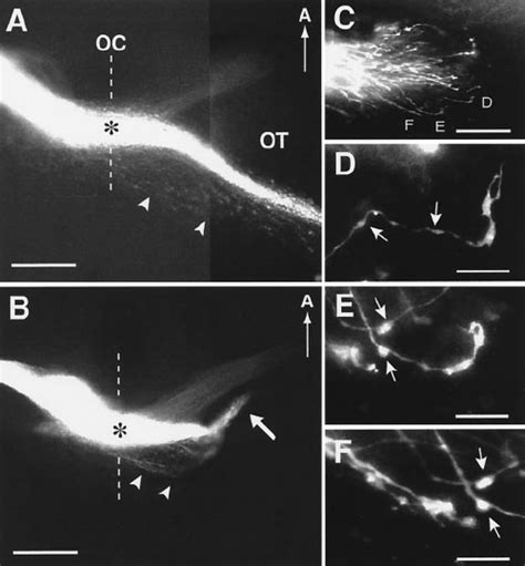 Rgc Axon Projection Patterns In Wild Type And Gap Ho Mozygous Null