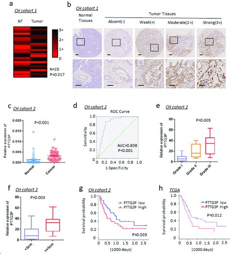 Pttg P Is Upregulated In Pdac Tissues A In Situ Hybridization Ish