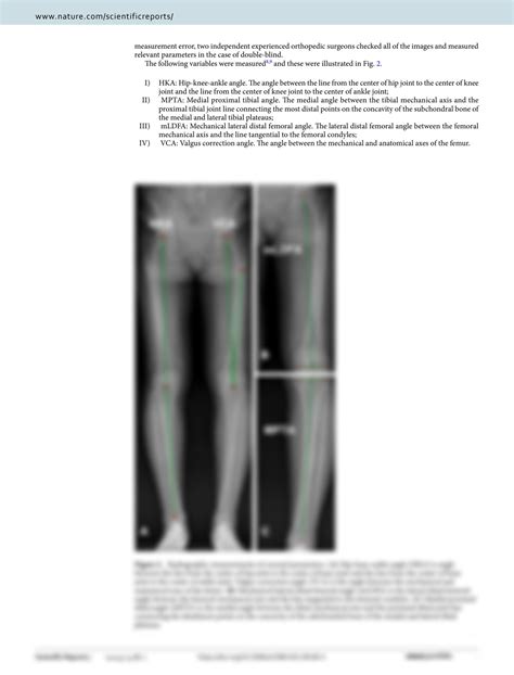 SOLUTION Lateral Distal Femoral Condyle Has More Uniform Cartilage