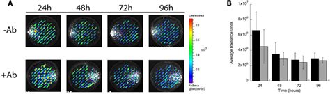 Frontiers In Vivo Bioluminescence Imaging Of Burkholderia Mallei