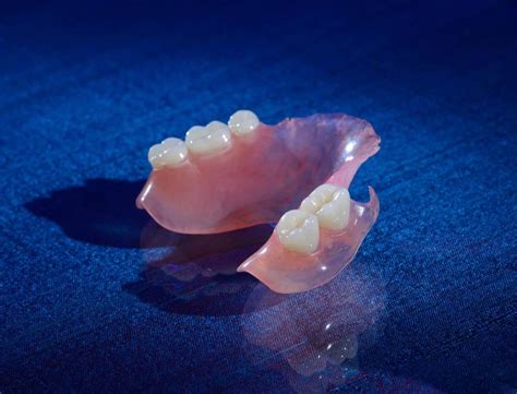 valplast success  partial dentures burbank dental lab