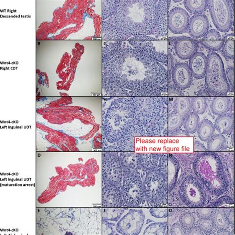 Characterization Of Wnt4 Cko Cdt And Udt In Different Testicular Cell