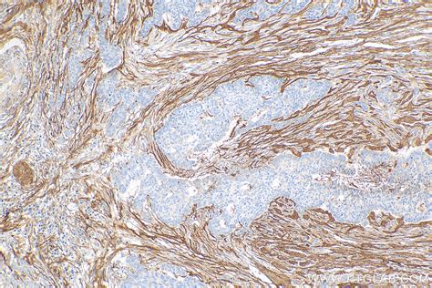 Periostin Antibody 19899 1 Ap Proteintech 武汉三鹰生物技术有限公司