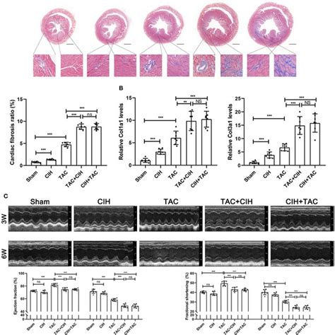 Cih Exposure Accelerates Cardiac Fibrosis And Cardiac Dysfunction In