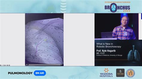 What is new in Robotic Bronchoscopy - Pulmonology On Air