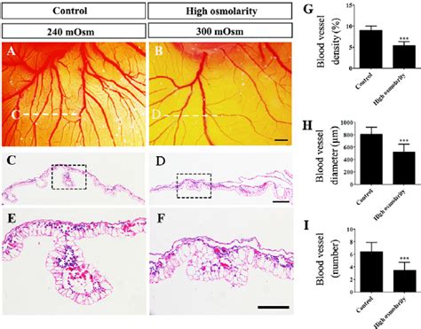 High Salt Exposure Limits Ventricular Wall Development In E4 5 Chick