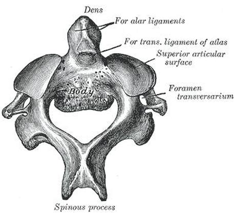 Pictures Of Axis Vertebra Odontoid Process