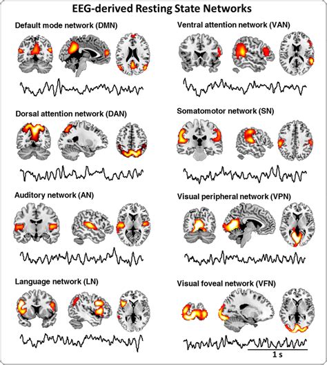 Broadband Eegderived Resting State Networks Rsns The Spatial Map