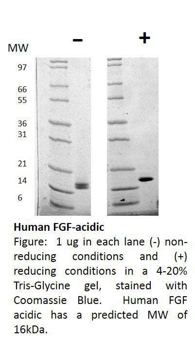 Human Connective Tissue Growth Factor Recombinant Protein