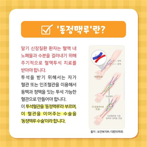 건강매거진 건강정보 가톨릭대학교 성빈센트병원