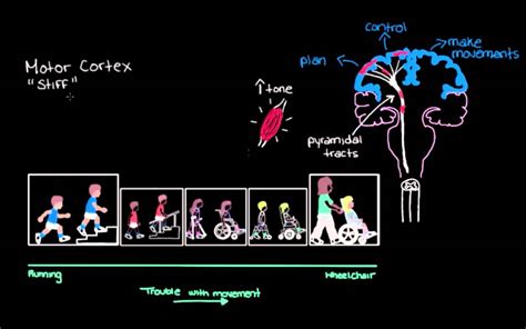 Khan Academy Types Of Cerebral Palsy Part 1 Spastic Youtube