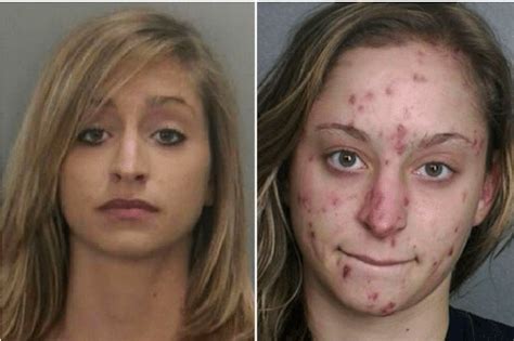 Faces Of Methamphetamine Use Before And After 2022