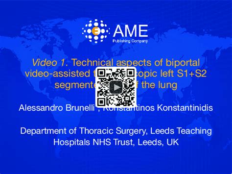 Technical Aspects Of Biportal Video Assisted Thoracoscopic Left S1 S2