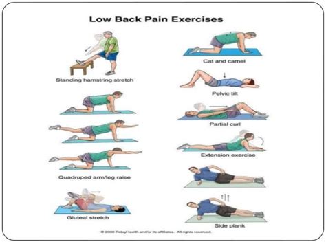 Lumbar Spondylosis, Spondylolisthesis and Radiculopathy