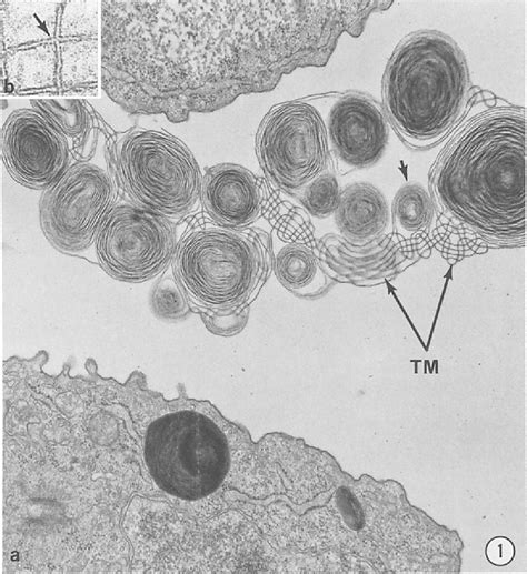 Figure From Conversion Of Lamellar Body Membranes Into Tubular Myelin