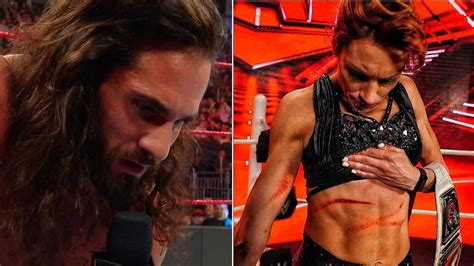 Seth Rollins Has 4 Word Reaction To Becky Lynchs Scars From Bianca