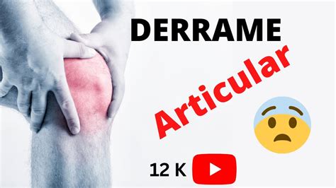 Tratamiento De Derrame Articular De Rodilla Youtube